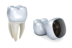 Dental crown