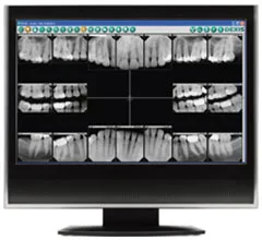 Digital dental x-ray